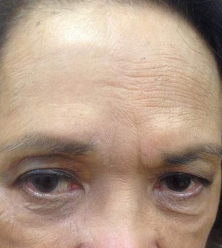 Jeunesse Instantly Ageless Before After Pictures